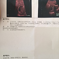 怀孕7周整，做了B超，有会看B超的宝妈没 有经验的宝妈们能看出男女不？