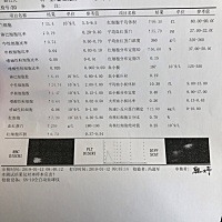 新生儿感染严重吗？医生让住院了，白细胞30多。好担心啊，有懂这方面的吗