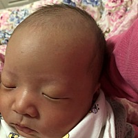 头上跟脸上，一粒一粒的是不是湿疹啊