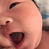 新生儿23天舌苔白厚  还有一点点黑色 有知道是怎么回事的嘛 急 求帮忙