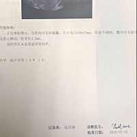 有没有经验的姐妹帮我看看呀！第一次37天去孕酮还28.85！第49天去做B超和孕酮就只有15.78…医生让我注意...