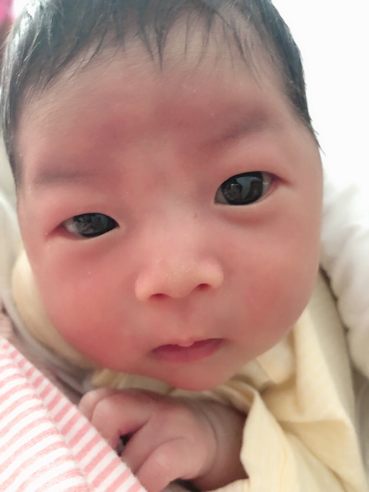 黄疸还没退干净～脐带已脱落～