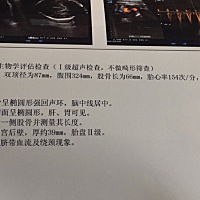 想知道是男宝宝还是女宝宝