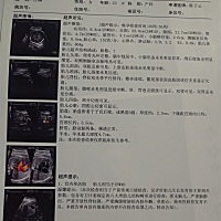 谁会看，男宝，女宝