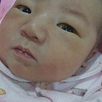 儿子出生眼球白里面有一条红色血块 医生说宝宝慢慢会吸收的  现在出生七天了 还是没消 有宝妈遇到这种情...