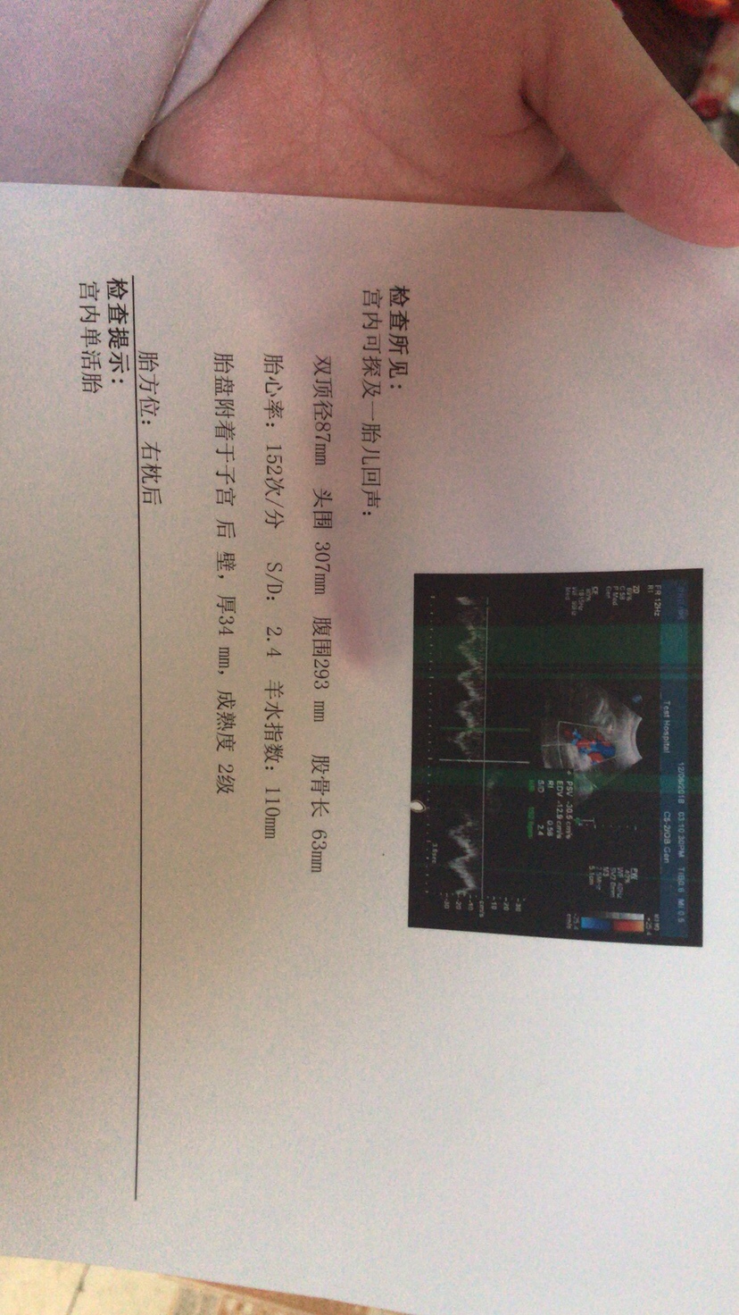 38周整了。感觉娃娃应该不小。一个孕期长了50多斤😭。谁会看帮看看小宝贝现在几斤了。打算顺产 好不好顺