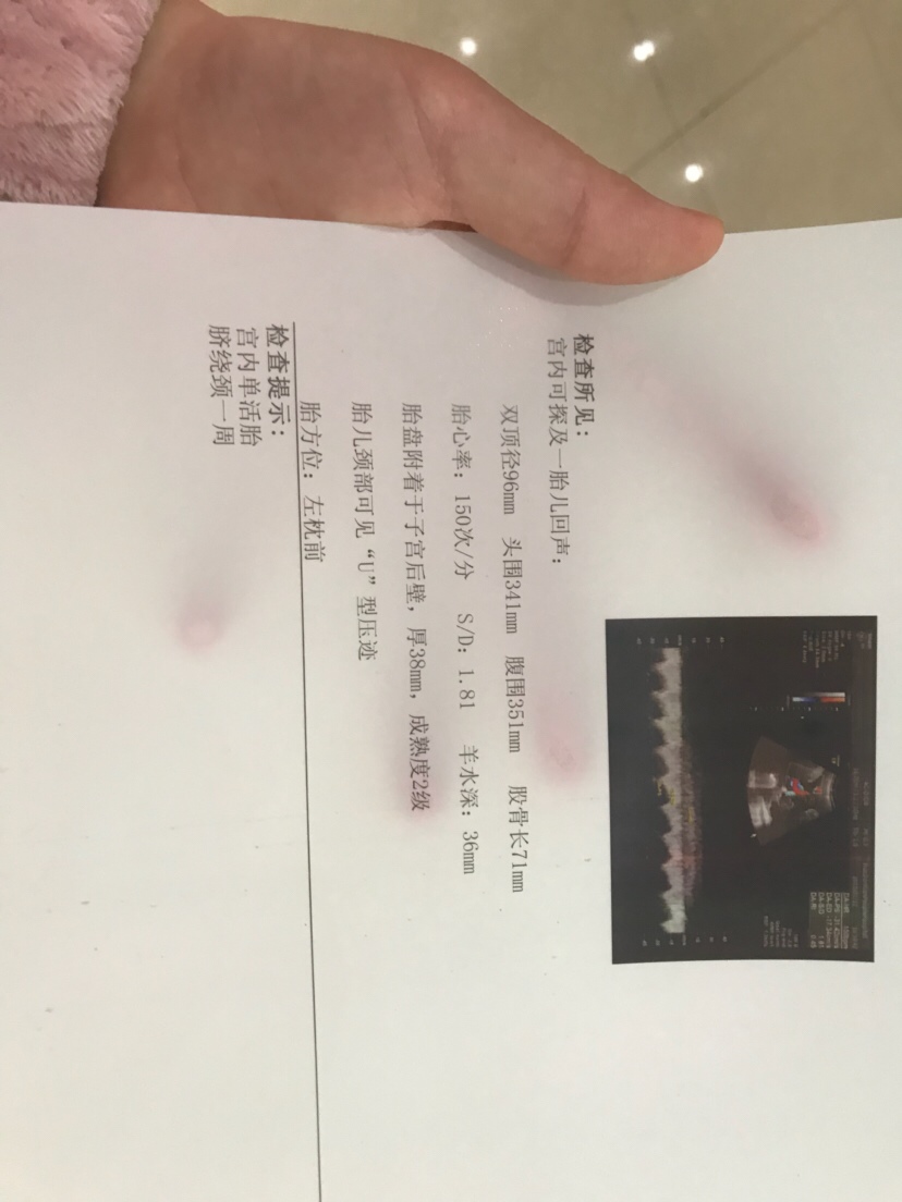 上个帖子图片发错了😂不知道咋删的。 这个是38周的刚检查的。能帮看看几斤了不  医生说不小