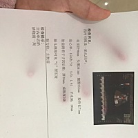 上个帖子图片发错了😂不知道咋删的。 这个是38周的刚检查的。能帮看看几斤了不  医生说不小