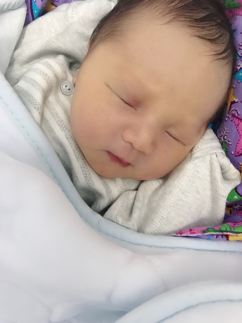 宝宝现在22天了，眼角里侧的红色还不消，会不会要做激光啊，心疼宝宝啊💔