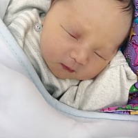 宝宝现在22天了，眼角里侧的红色还不消，会不会要做激光啊，心疼宝宝啊💔