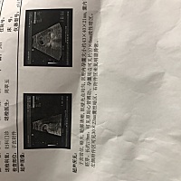 今天8周了，刚去做的b超，希望宝妈一切都顺利，一把年纪了怀上真的不易！