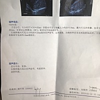 怀孕三十天之内吃了药 现在我好担心会不会有影响 该不该留 哎 ！求助