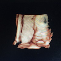 是佩奇还是乔治。有看得懂的吗，男女都一样，比较好奇而已～