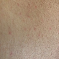 肚皮上有红点，是不是过敏了，但是不痒，有遇到的么