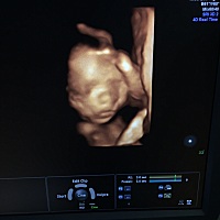 21周四维是个男孩子，还有没有翻盘的可能😂😂，一直以为是个女儿，都是“妹妹…妹妹…”的叫