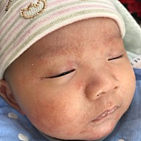 宝宝这两天脸上突然这样了，有宝妈遇到过这样的吗？