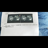 这个看得出男女宝吗？？？