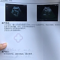 怀孕应该有50天 结果不太好 请问有经验的 这还有希望嘛？