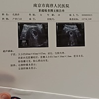 6周 6天。还没有胚芽，胎心搏动未见，是怎么回事了，求解