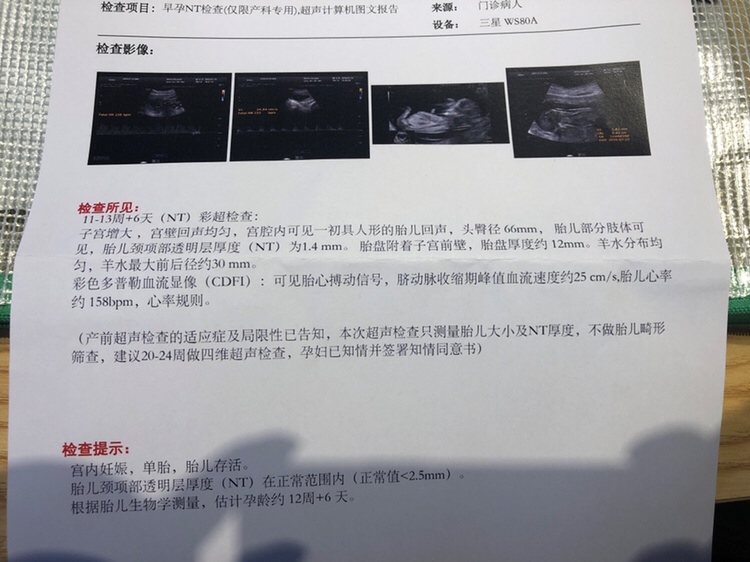 都说看B超就知道男女，有谁能告诉我呢？