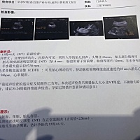 都说看B超就知道男女，有谁能告诉我呢？