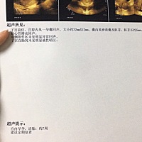 前天去照的b超，7周，胚芽胎心都有了，松了一口气。可是今天早上流有褐色分泌物，心一下就害怕了，去医...