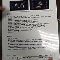 以为不长妊娠纹，最后一个月都长了～