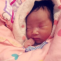 我想知道我宝宝眼睛上面这个是胎记吗？一出生就有，会消掉吗？好担心呀？有谁的宝宝有这样的红块后面消...