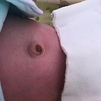 有没有宝宝肚脐眼突出来的呢？怎么处理的？网上卖的脐疝带效果好吗？要不要管它呢？好多问题，有经验的...