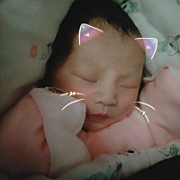 今天回医院给宝宝采血什么的 没带我去 之前看着脸有点发黄 担心是不是黄疸 牙龈上有白色斑块的东西 害怕...