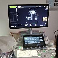 各位帮我看下这是男宝宝吗 ？