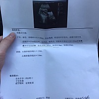 有过来人帮我看一下是男孩女孩？怀孕8周＋谢谢