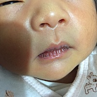 宝宝7天 嘴巴干怎么办  正常吗？