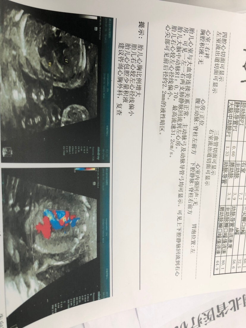 怎么办，很严重吗？