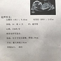 大家猜猜是男宝女宝，本人已经知道