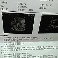 大家帮忙看一下 男孩女孩啊