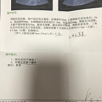 宝宝一个月，今天去做卤门B超！双侧室管膜下囊肿 ，这个到底严不严重！吓死为娘我了