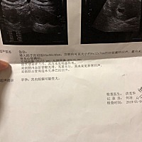 早期壬辰囊是9*12*7mm，能看出男女吗？