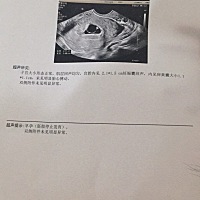 宝宝下一次一定要抓紧妈妈的手 妈妈等着你！