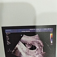 大家帮我看看男孩女孩，3个多月。