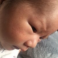 这脸上的到底是什么啊？都20天了，之前买了红色蜗牛涂了半个月虽然没有好但也有的效果，红色的点点没有...