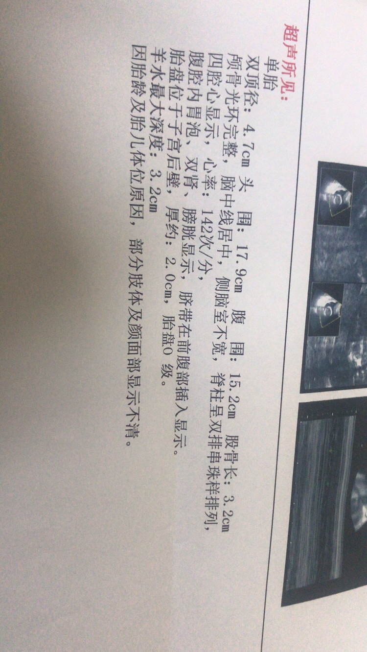 为什么老是感觉给我检查的医生不靠谱啊，而且收费的那个医生态度很不好。大家看下孩子大小好着没？20 2了。