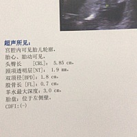 NT顺利通过了，感恩～宝妈们可以看出男女吗？