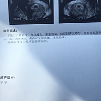 帮忙看看男孩女孩？