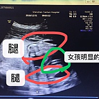 被我看到了是女孩。