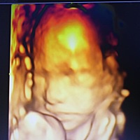 新出炉的四维报告单，大家能看看男女吗？😂