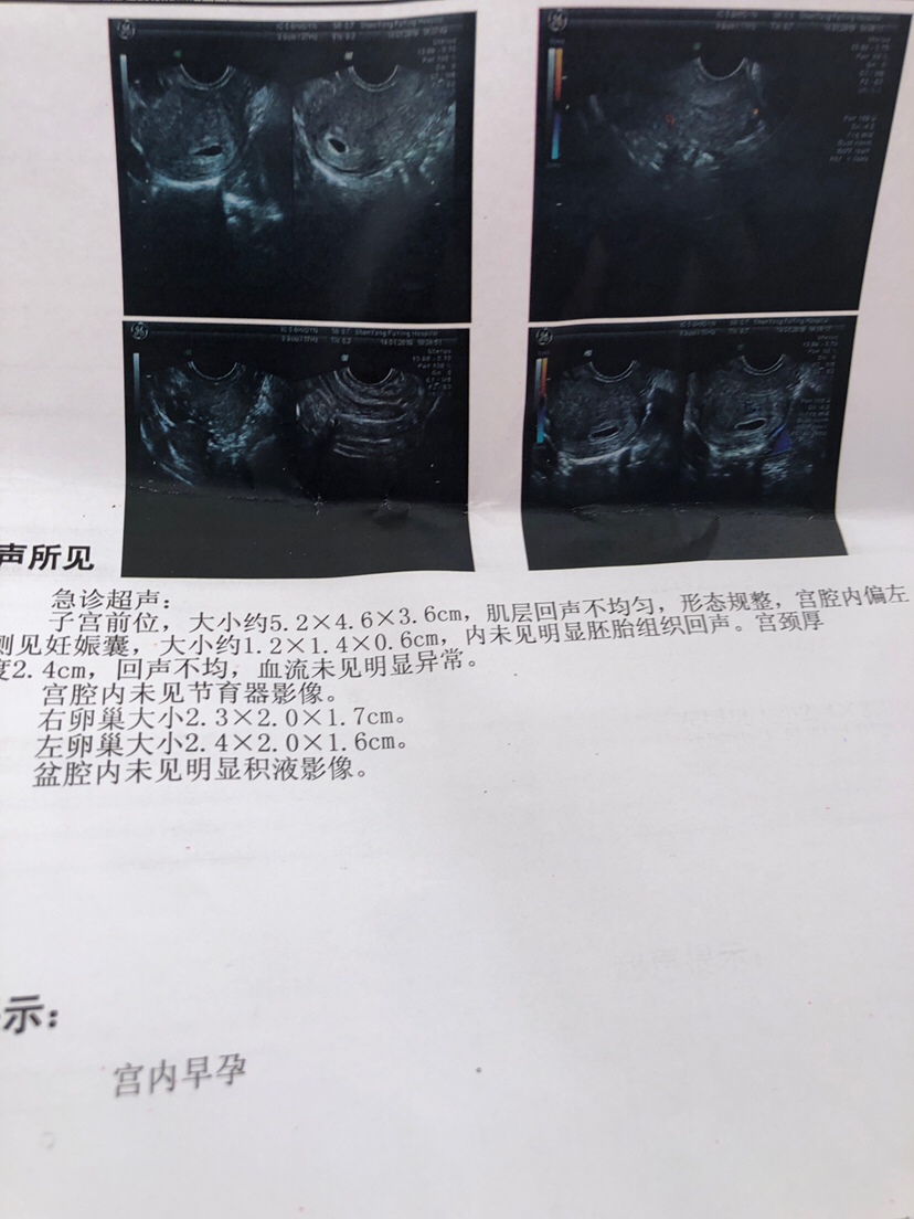 这是第一次去我们这市妇幼医院彩超检查结果！
