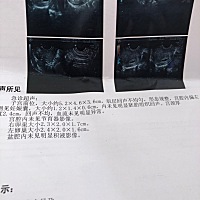 各位宝妈好，我是一名34岁见习宝爸，跟未婚女友去旅游回来发现女友意外怀孕了，初为人父，真的又兴奋又...