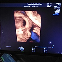 宝妈们看看是男孩，是女孩特别好奇，前面2个是男孩子，这一次不知道，有都说，彩超图上面英文字怎么怎么...