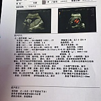 我的双胞胎宝宝还有109天就要出生了。真的很开心很快乐，爸爸妈妈爱你